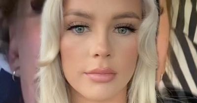 'I ignored warnings not to drink after getting my lips done - it was a mistake'