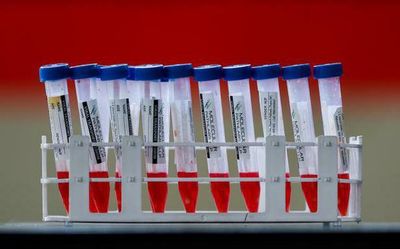 T.N. reports 22 fresh cases of COVID-19