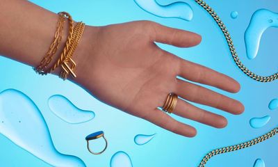 Suspect a jewellery allergy? There may be a simpler explanation