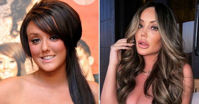 Charlotte Crosby's changing face after spending rumoured £20k on plastic surgery