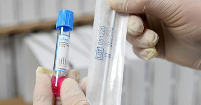 'Small number' of new Covid variant cases in Northern Ireland, public health officials confirm