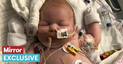 Baby given just months to live due to rare condition inherited from BOTH parents' genes