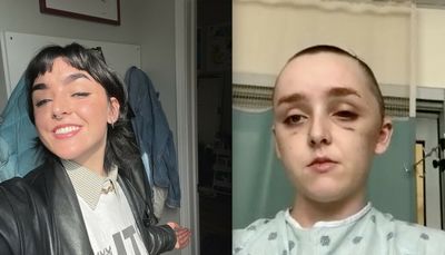 Columbia student struck by falling building debris in Wicker Park faces ‘slow and tedious’ recovery, will miss graduation
