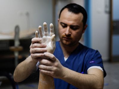 Bionic limbs lift Gaza amputees' self-esteem