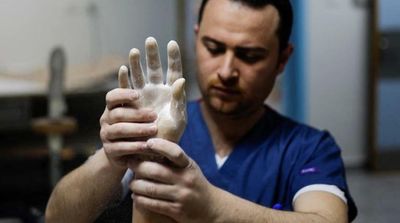 Bionic Limbs Lift Gaza Amputees’ Self-Esteem