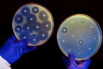 Scientists record sounds from bacteria