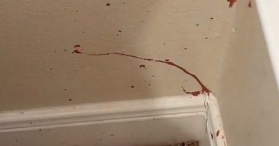 Woman urged to 'get out' of Airbnb after finding blood spatters and dent in wall