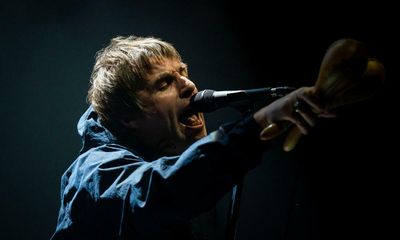 Hips don’t lie, Liam Gallagher – there’s no shame in getting them fixed