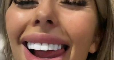 Woman shares bizarre beauty hack to get a dazzling smile - but dentists aren't impressed