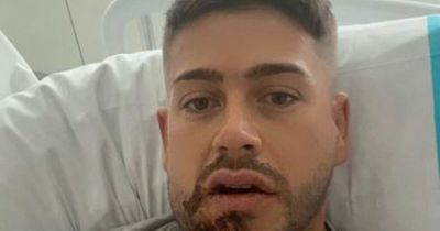 Geordie Shore's Ant Kennedy left with broken jaw and needing surgery after first night in Ibiza