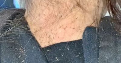 Hairdresser horrified by girl's six month lice infestation that took nine hours to remove