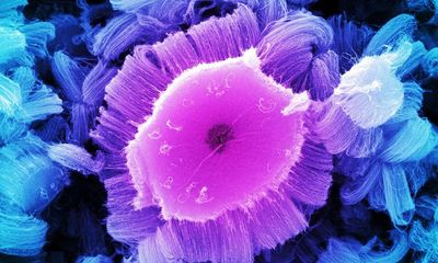 Nano state: tiny and now everywhere, how big a problem are nanoparticles?