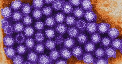 How to tell if you have norovirus and how to treat it