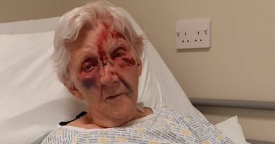 Woman, 94, hospitalised after suffering horror injuries after tripping on dangerous pavement