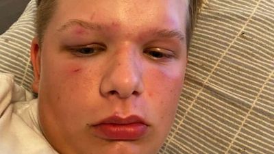 Mother of boy with autism angry that teen who allegedly bashed son is not charged
