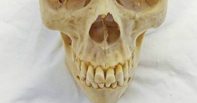 Human remains removed from Scots auction sale after backlash