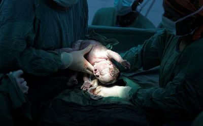 Baby delivered under torch light in Telangana as PHC sees power outage