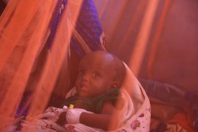 Malnourished kids crowd hospital as Ethiopia hit by worst drought in 40 years