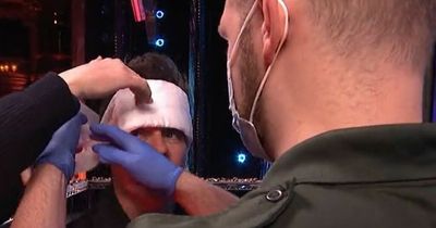 Britain's Got Talent's Ant McPartlin left bleeding backstage as medic rushes in