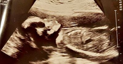 Woman goes for baby scan and sees 'demonic skull' looking back at her