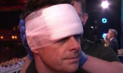 Ant McPartlin bloody and bandaged after smashing his head on a coconut at BGT auditions