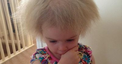 Mum given diagnosis about daughter's hair after appearing on The One Show