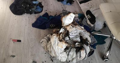 Schoolgirl injured and room set ablaze after deodorant can explodes