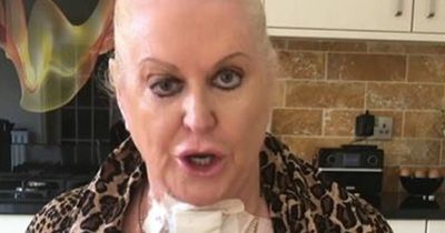 Kim Woodburn declares she's 'not dying' as she swigs gin after having throat cut