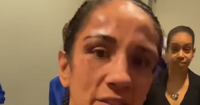 Katie Taylor's opponent Amanda Serrano shows off considerable facial injuries after battle