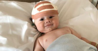 Baby boy's 'boat shaped' head was sign of life threatening condition