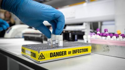 COVID 19: How Your Genes Affect Your Survival