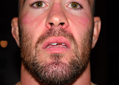 Close-up photos of Colby Covington after alleged Jorge Masvidal assault appear in motion filed by defense