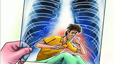 Nine new TRUNAAT machines for early diagnosis of tuberculosis in Indore
