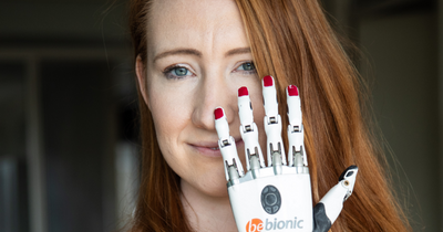 'Bionic' woman was born with limbs missing - but prosthetics have changed her life