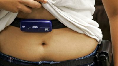 Health chiefs call for action over rising obesity rates in Europe