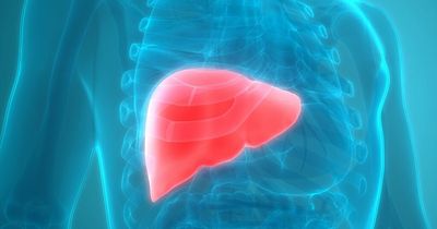 Fatty liver disease - warning signs of silent killer one in three of us are already developing