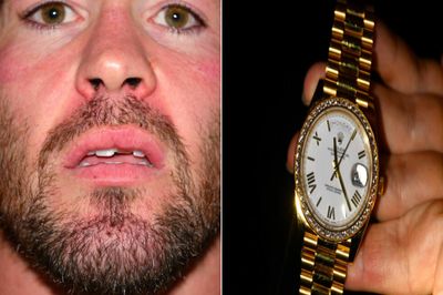 Photos: Colby Covington (and his Rolex) immediately after alleged Jorge Masvidal attack