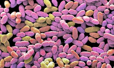 Certain gut microbes may affect stroke risk and severity, scientists find