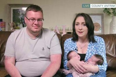 Separation of ‘miracle’ conjoined twins delayed after Covid infection