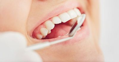 Early warning signs of mouth cancer and four symptoms to look out for