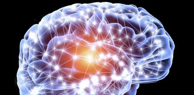 You've likely heard of the brain's gray matter – here's why the white matter is important too
