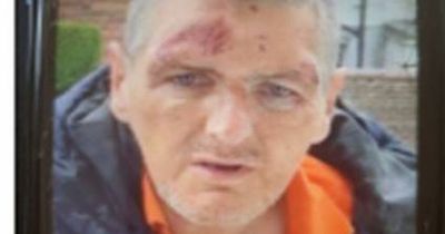 Glasgow police launch fresh appeal to trace Govan man missing for 10 days