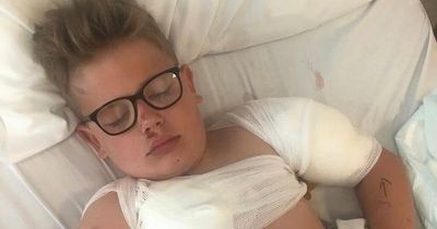 Boy, 7, left needing plastic surgery after loose dog tried 'tearing him to bits'