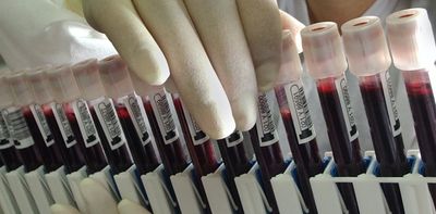 COVID-19 official counts can miss mild cases – here's how serosurveys that analyze blood for signs of past infection can help