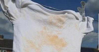 Mum shares little-known method to remove stains from baby clothes - and it's free to do