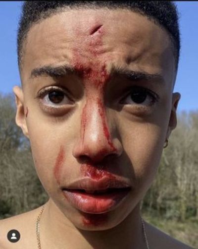 Police reopen case after Black child attacked with boat paddle in Bristol
