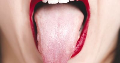 Dry mouth could be a sign of five serious illnesses, says dentist