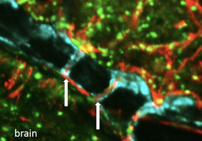 Study finds tiny channels in skull that could play ‘vital role’ in meningitis treatment