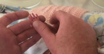 ‘Miracle’ baby born at just 23 weeks had hands the size of her dad’s fingernail