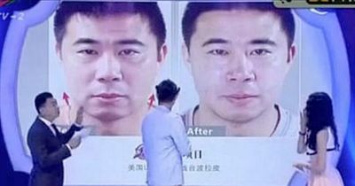 Dong Fangzhuo now: Forgotten Man Utd forward given guard of honour and 'plastic surgery'